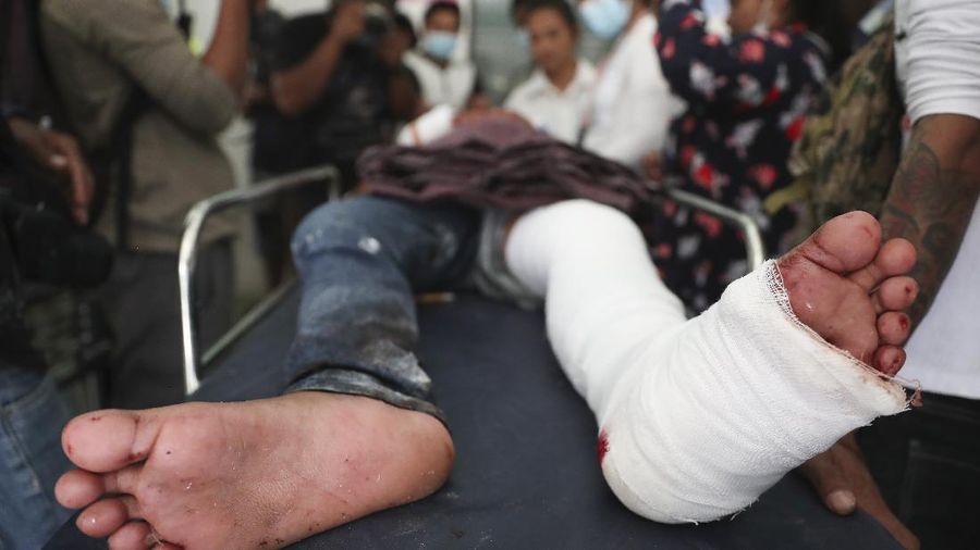 A protester show bullets, shotgun shells and rubber bullets used by security forces during a demonstration against the military coup in Mandalay, Myanmar, Friday, Feb. 26, 2021. (AP Photo)