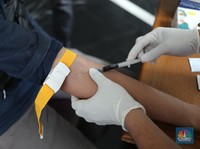 Bisa Mematikan! Pikir-Pikir Dulu Sebelum Punya Tato, Ada Efek Bahaya