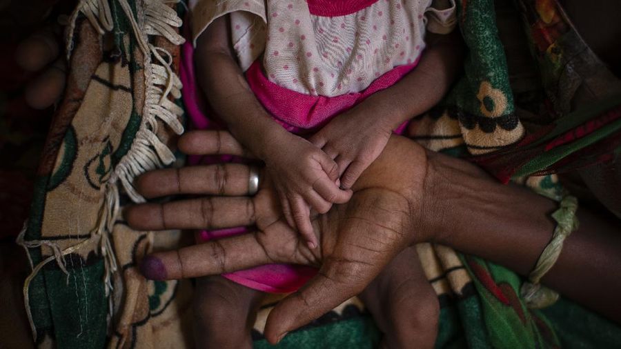 Abeba Gebru, 37, from the village of Getskimilesley, holds the hands of her malnourished daughter, Tigsti Mahderekal, 20 days old, in the treatment tent of a medical clinic in the town of Abi Adi, in the Tigray region of northern Ethiopia, on Tuesday, May 11, 2021. She had the baby at home and walked 12 days to get the famished child to a clinic in the northern Ethiopian region of Tigray. “She survived because I held her close to my womb and kept hiding during the exhausting journey.