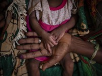 Miris! Separuh Orang Lapar di Dunia Warga Asia, bukan Afrika