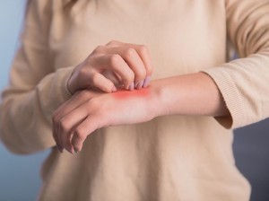 Ciri-ciri Gejala Penyakit Ginjal yang Bisa Muncul di Kulit
