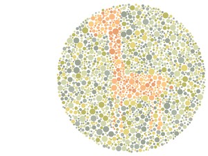Kelihatan Nggak? Cuma yang Punya Mata Tajam yang Bisa Lihat Hewan di Gambar Ini