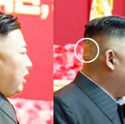 Heboh Perban di Bagian Belakang Kepala Kim Jong Un, Ada Apa?