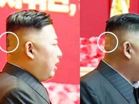 Heboh Perban di Bagian Belakang Kepala Kim Jong Un, Ada Apa?