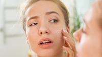 Kulit Kering dan Iritasi Ringan? Ini 5 Cara Pakai Moisturizer Balm Multifungsi yang