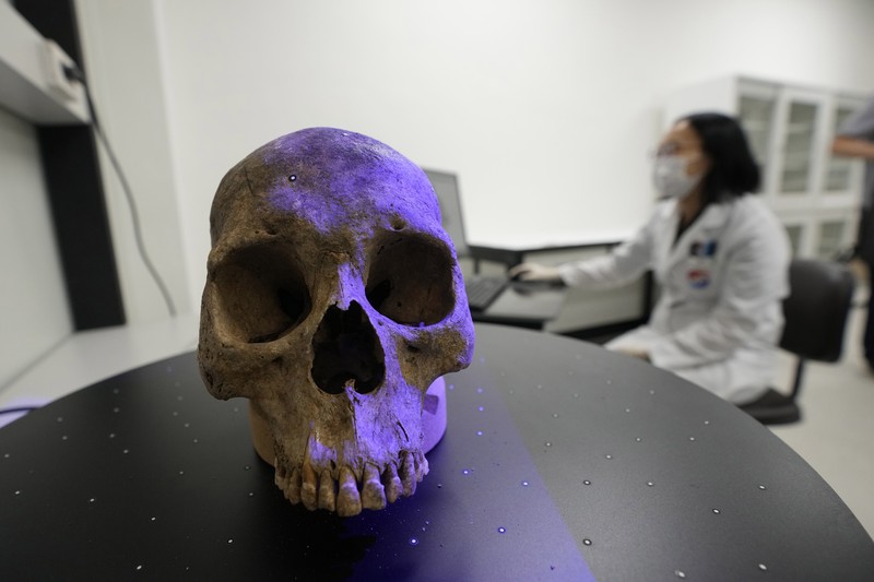 Lee Kyu-chang, a member of the central identification laboratory at the Ministry of National Defense Agency for Killed in Action Recovery & Identification, watches a screen showing dental X-rays of an unidentified soldier killed during the Korean War at the National Cemetery in Seoul, South Korea on July 26, 2021. The Korean War ended 68 years ago, but South Korea is still trying to recover its soldiers' remains. (AP Photo/Ahn Young-joon)