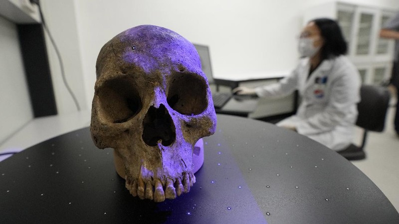 Lee Kyu-chang, a member of the central identification laboratory at the Ministry of National Defense Agency for Killed in Action Recovery & Identification, watches a screen showing dental X-rays of an unidentified soldier killed during the Korean War at the National Cemetery in Seoul, South Korea on July 26, 2021. The Korean War ended 68 years ago, but South Korea is still trying to recover its soldiers' remains. (AP Photo/Ahn Young-joon)