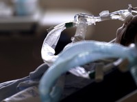 Resmi! Covid Jadi Wabah Paling Mematikan, Gantikan Flu 1918