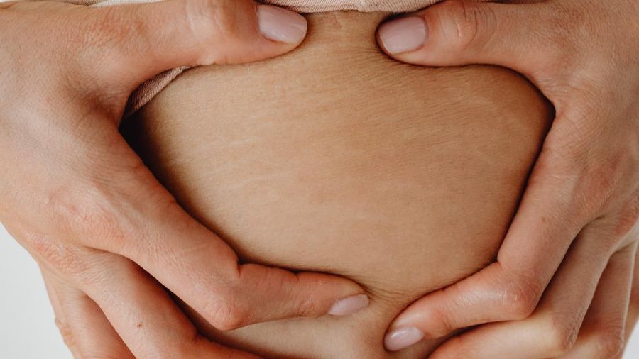 stretch mark
