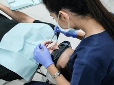 9 Perawatan Gigi yang Ditanggung BPJS Kesehatan, Veneer Gigi?