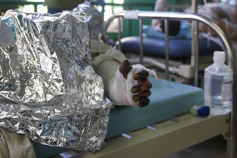 Kebakaran truk Bahan Bakar yang Meledak di Cap Haitien, Haiti Warga berdiri di tengah rumah yang rusak akibat truk bensin terbalik dan meledak di Cap-Hatien, Haiti, Selasa (14/12/2021). Ledakan itu menghanguskan mobil dan rumah, menewaskan lebih dari 50 orang dan melukai puluhan lainnya. (AP/Joseph Odelyn)