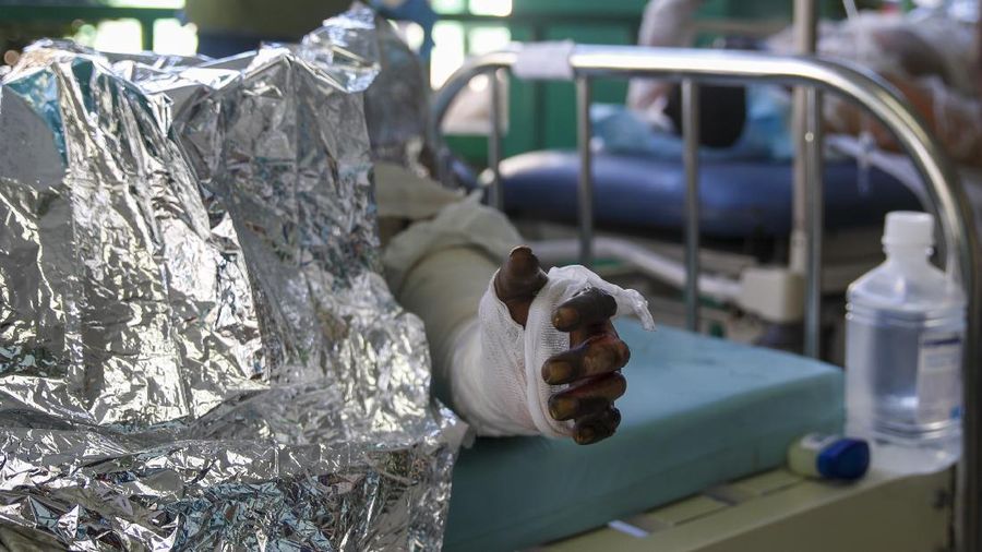 Warga berdiri di tengah rumah yang rusak akibat truk bensin terbalik dan meledak di Cap-Hatien, Haiti, Selasa (14/12/2021). Ledakan itu menghanguskan mobil dan rumah, menewaskan lebih dari 50 orang dan melukai puluhan lainnya. (AP/Joseph Odelyn)