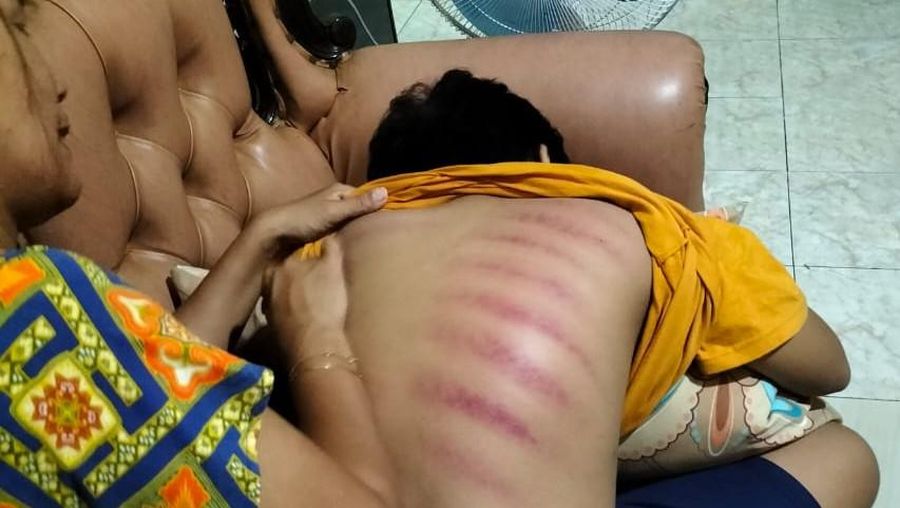 Kerokan biasa dilakukan masyarakat saat masuk angin.