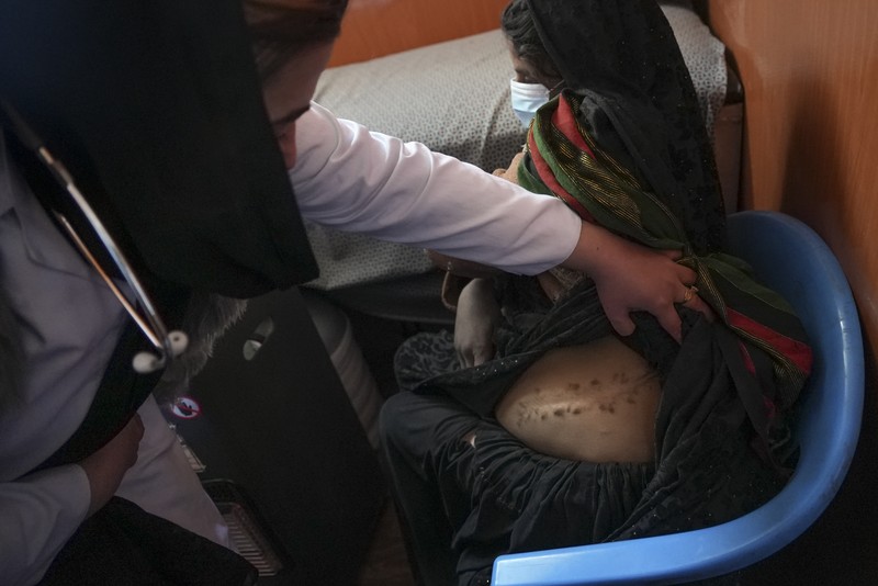 Kemiskinan dan Gizi Buruk anak Afghanistan Hamid Abdullah berdiri di luar ruangan tempat anak-anaknya bermain di sebuah pemukiman dekat Herat, Afghanistan (16/12/2021). Abdullah menjual putrinya yang masih kecil untuk dijodohkan karena sangat membutuhkan uang untuk mengobati istrinya yang sakit kronis dan hamil anak kelima mereka . (AP/Mstyslav Chernov)