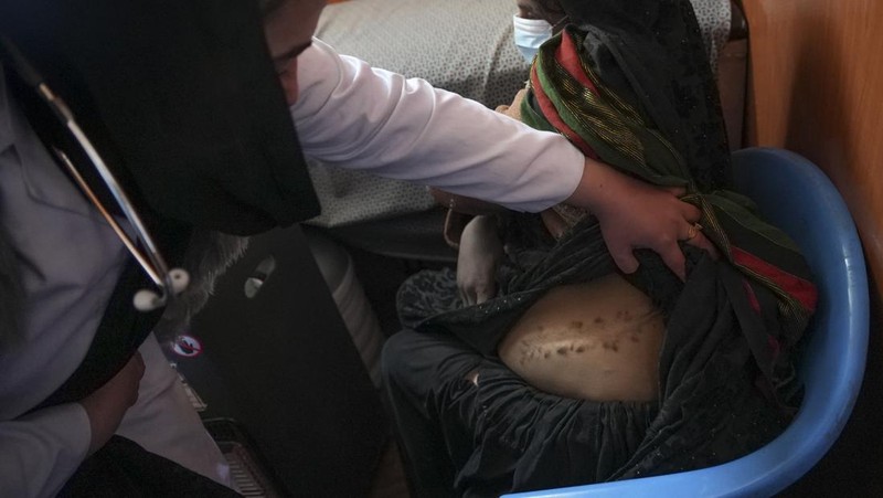 Hamid Abdullah berdiri di luar ruangan tempat anak-anaknya bermain di sebuah pemukiman dekat Herat, Afghanistan (16/12/2021). Abdullah menjual putrinya yang masih kecil untuk dijodohkan karena sangat membutuhkan uang untuk mengobati istrinya yang sakit kronis dan hamil anak kelima mereka . (AP/Mstyslav Chernov)