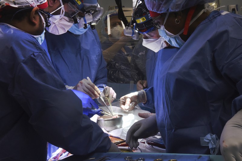Fakultas Kedokteran Universitas Maryland menunjukkan jantung babi untuk ditransplantasikan ke pasien David Bennett di Baltimore pada Jumat, (7/1/2022). (Mark Teske/University of Maryland School of Medicine via AP)