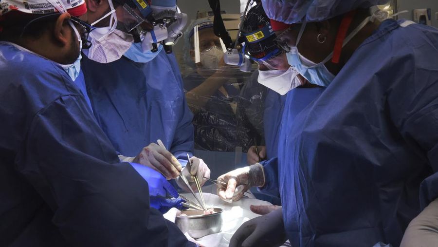 Fakultas Kedokteran Universitas Maryland menunjukkan jantung babi untuk ditransplantasikan ke pasien David Bennett di Baltimore pada Jumat, (7/1/2022). (Mark Teske/University of Maryland School of Medicine via AP)