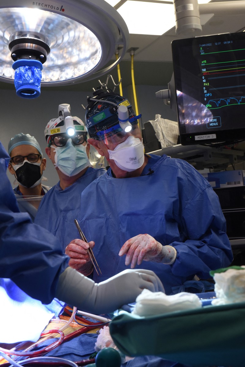 Fakultas Kedokteran Universitas Maryland menunjukkan jantung babi untuk ditransplantasikan ke pasien David Bennett di Baltimore pada Jumat, (7/1/2022). (Mark Teske/University of Maryland School of Medicine via AP)