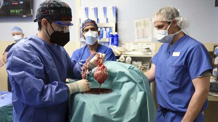 Fakultas Kedokteran Universitas Maryland menunjukkan jantung babi untuk ditransplantasikan ke pasien David Bennett di Baltimore pada Jumat, (7/1/2022). (Mark Teske/University of Maryland School of Medicine via AP)