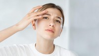 Jerawat Datang Tiba-Tiba? 2 Krim Spot Treatment Ini Bisa Dipakai Langsung di Titiknya 