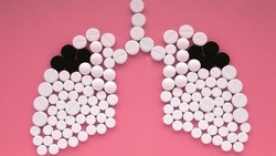 Kasus TB di Malaysia Meledak, Pakar Ingin RI Tiru Cara Pelaporan Negeri Jiran