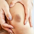 Gejala Kolesterol Tinggi Bisa Terlihat di Jari & Kuku, Cek!