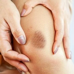 Gejala Kolesterol Tinggi Bisa Terlihat di Jari & Kuku, Cek!