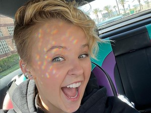 Jojo Siwa Curhat Alami Kebotakan Dini karena Stres Jadi Artis