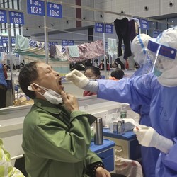 Ngeri! Gejala Virus Langya Bisa Picu Gagal Ginjal
