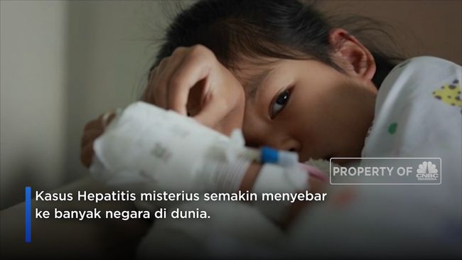 Alert!  These are the 3 stages of acute hepatitis symptoms that attack children