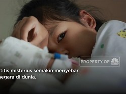 Ada Gejala Ini? Awas, Bisa Jadi Hepatitis Misterius