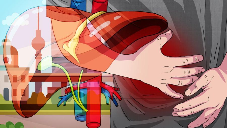 Ini gejala dan cara penanganan Hepatitis Akut