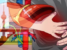 Ada Kabar Baik dari Kemenkes Soal Hepatitis Akut Misterius RI