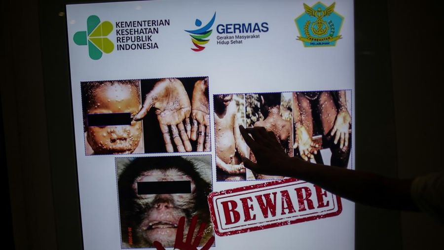 Seorang penumpang berjalan di depan informasi virus monkeypox di Bandara Internasional Soekarno-Hatta di Tangerang dekat Jakarta, Indonesia. Monkeypox adalah penyakit menular yang endemik virus monkeypox dari bagian Tengah dan Barat Afrika yang membuat manusia luka, demam, nyeri otot dan kedinginan. (Jepayona Delita/Penerbitan Masa via Getty Images)
