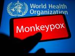 Muncul Teori Konsiprasi soal Cacar Monyet, Sebut China & AS