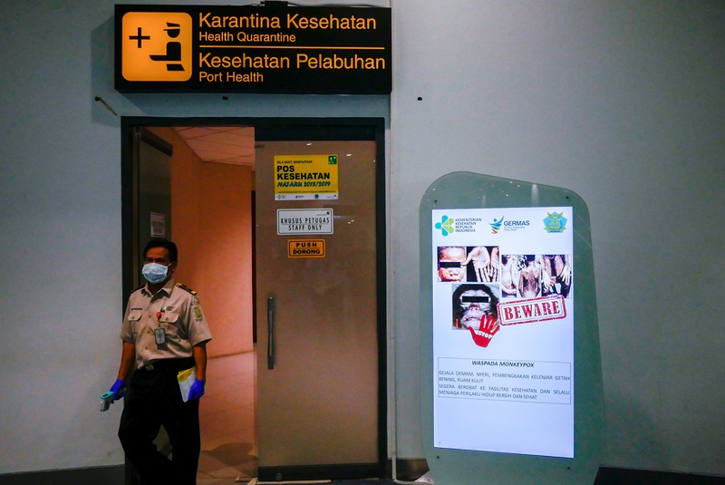Telapak tangan pasien kasus cacar monyet dari Lodja, sebuah kota yang terletak di dalam Zona Kesehatan Katako-Kombe, terlihat selama penyelidikan kesehatan di Republik Demokratik Kongo pada tahun 1997. (via REUTERS/CDC)