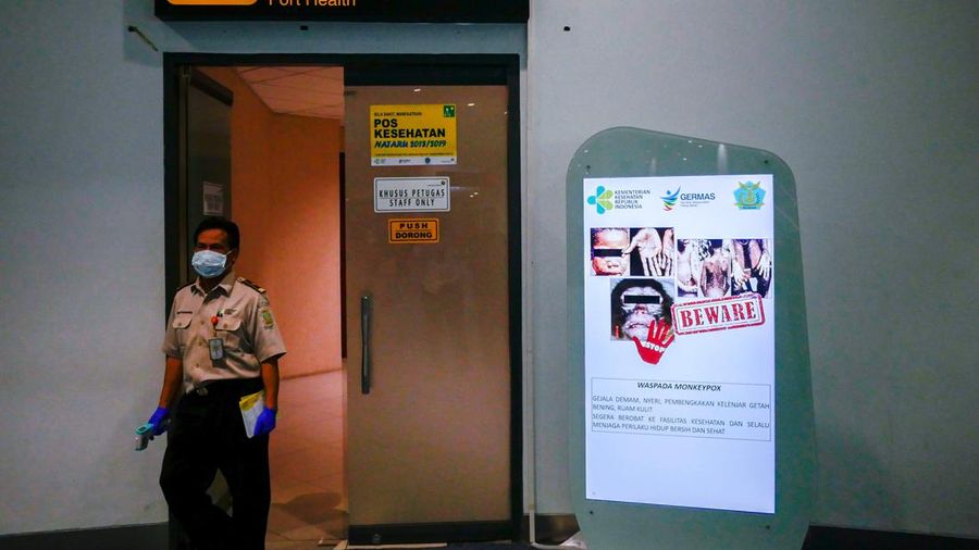 Telapak tangan pasien kasus cacar monyet dari Lodja, sebuah kota yang terletak di dalam Zona Kesehatan Katako-Kombe, terlihat selama penyelidikan kesehatan di Republik Demokratik Kongo pada tahun 1997. (via REUTERS/CDC)