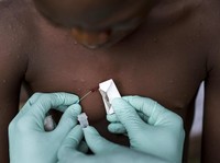 Waspada, Ini Daftar 10 Kelompok yang Rentan Tertular Mpox