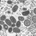 WHO Umumkan Wabah Mpox alias Cacar Monyet Darurat Kesehatan Global