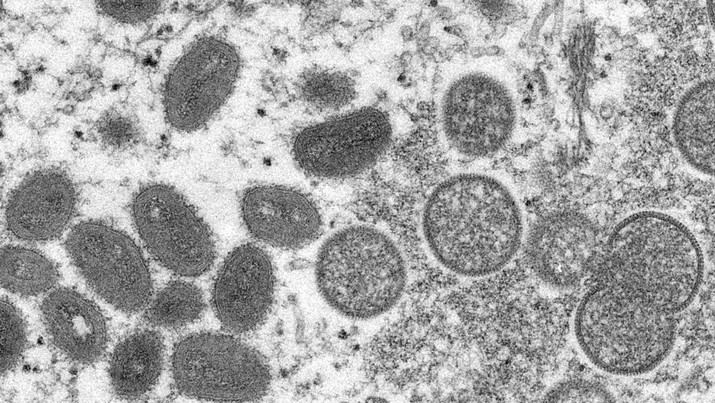 Gambar mikroskop elektron yang disediakan oleh Pusat Pengendalian dan Pencegahan Penyakit ini menunjukkan virion cacar monyet. (Cynthia S. Goldsmith, Russell Regner/CDC via AP)