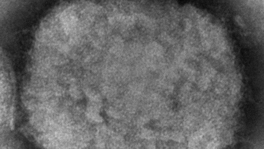 Gambar mikroskop elektron yang disediakan oleh Pusat Pengendalian dan Pencegahan Penyakit ini menunjukkan virion cacar monyet. (AP/Cynthia S. Goldsmith, Russell Regner)