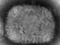 Hati-hati Wabah Monkeypox, Cek Daftar Gejala Cacar Monyet