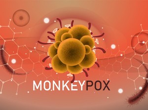 Anggota DPR Minta Pemerintah Tak Anggap Enteng Mpox: Belajar dari Covid