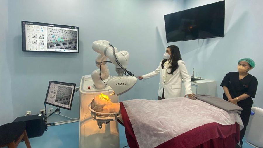Transplantasi Rambut Robotik (CNBC Indonesia/Lynda Hasibuan)