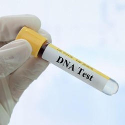 Jangan Ikut Tren Uji DNA Sebelum Tahu 5 Risiko Ini