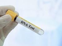 Startup Ini Ikut Kemenkes Kumpulkan Sampel DNA Semua Warga RI