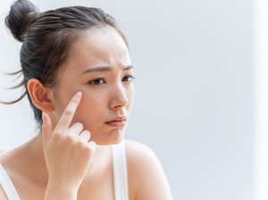 Skin Barrier Rusak? Ini Ciri-ciri dan Cara Mengatasinya