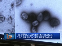 Filipina Laporkan Kasus Cacar Monyet Pertama