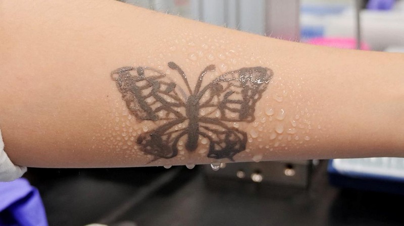 Steve Park, Materials Science & Engineering professor at Korea Advanced Institute of Science and Technology (KAIST), demonstrates an electronic tattoo (e-tattoo) on his arm connected with an electrocardiogram (ECG) monitoring system in Daejeon, South Korea, July 26, 2022.   REUTERS/Minwoo Park