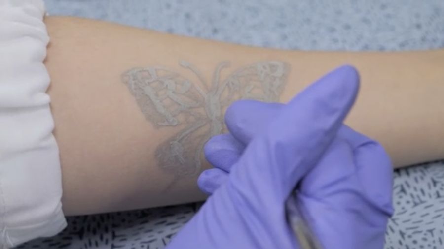 Steve Park, Materials Science & Engineering professor at Korea Advanced Institute of Science and Technology (KAIST), demonstrates an electronic tattoo (e-tattoo) on his arm connected with an electrocardiogram (ECG) monitoring system in Daejeon, South Korea, July 26, 2022.   REUTERS/Minwoo Park